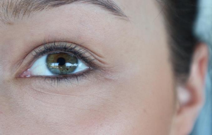 Kajine trepalnice pred uporabo seruma Lux-Factor Eyelash. | Foto: 