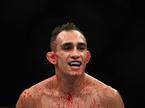 Tony Ferguson