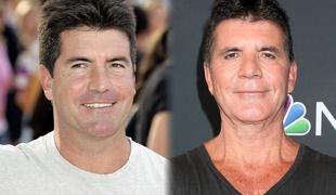 Simon Cowell priznal, da je pretiraval z botoksom: Sin me ni prepoznal