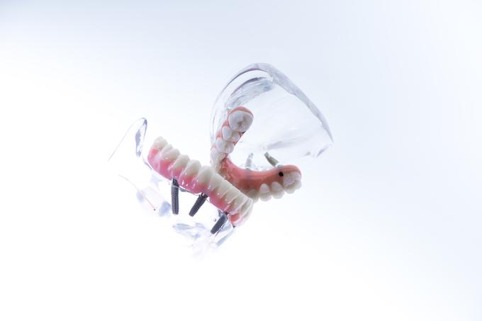 Ortoimplant | Foto: ORTOIMPLANT DENTAL SPA