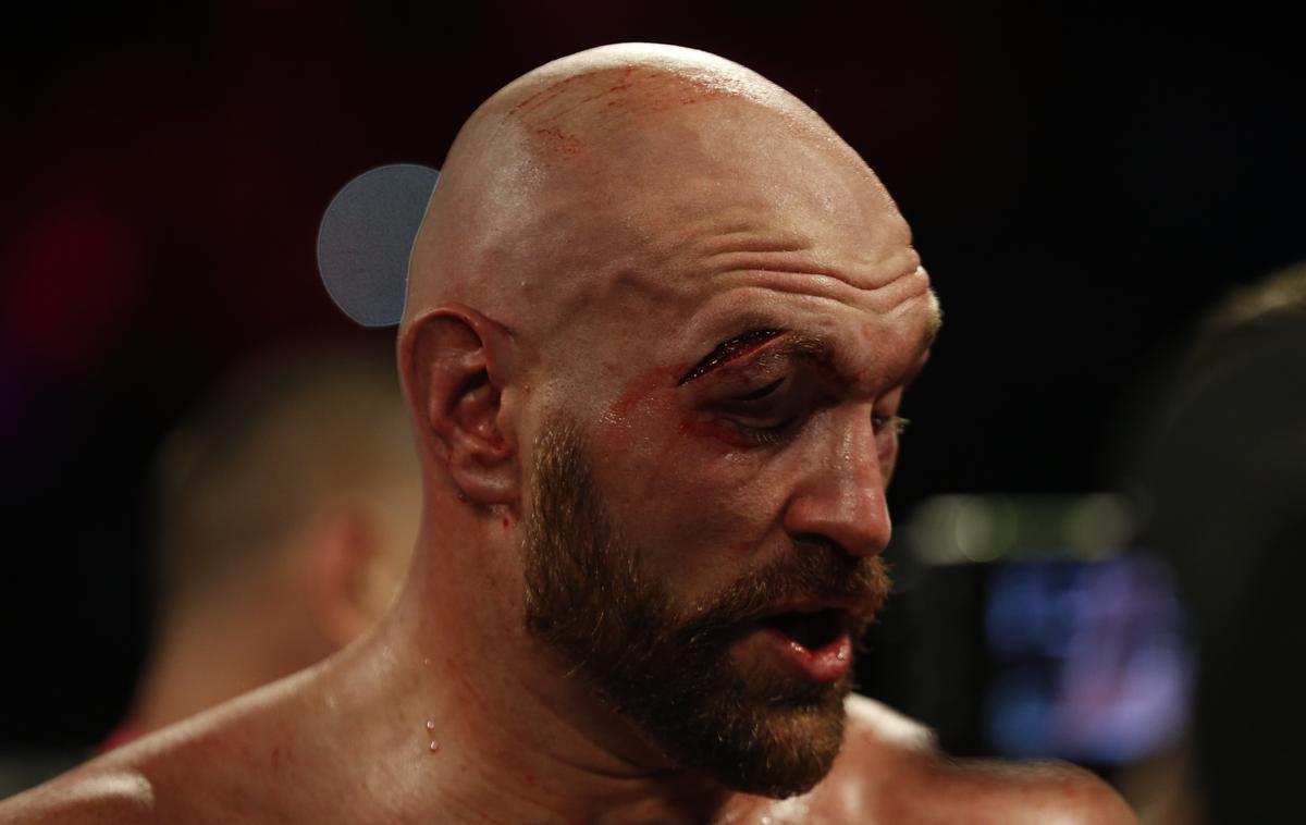 Tyson Fury | Tyson Fury je takoj po dvoboju odšel v bolnišnico. | Foto Reuters