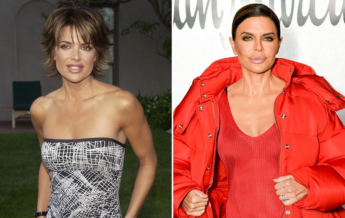 Lisa Rinna B&A | Foto Cover Images