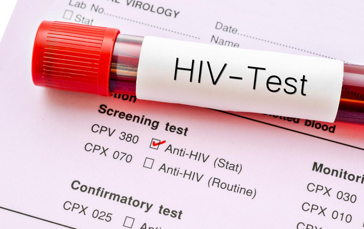 HIV Aids | Foto Thinkstock