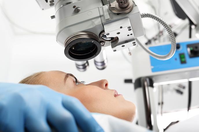 Laserska operacija, dioptrija, lasik | Fotografija je simbolična. | Foto Thinkstock