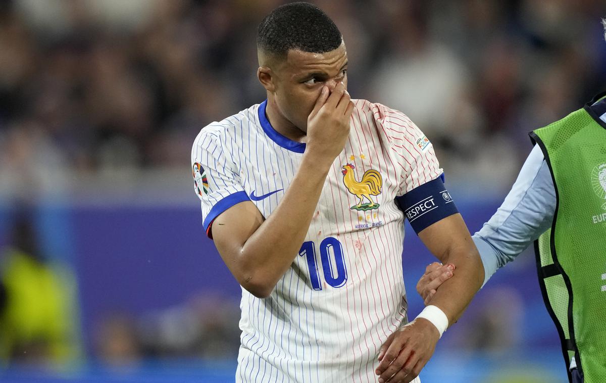 Mbappe Kylian poškodba Euro | Kylian Mbappe si je na uvodni tekmi prvenstva poškodoval nos. | Foto Guliverimage