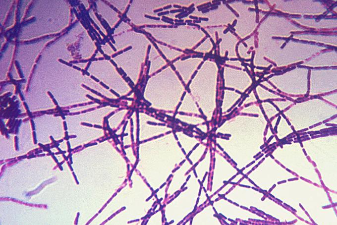 Bacillus anthracis je gram pozitivna bakterija, ki tvori spore. Te spore so sposobne preživeti v naravnem okolju izjemno dolgo. Okužbo povzročijo spore, vegetativne oblike le redko. Antraks se pojavlja povsod po svetu, najpogosteje pa na kmetijskih področjih, kjer nimajo vpeljanih preventivnih programov nadzora antraksa pri domačih rastlinojedih živalih (Vir: NIJZ). Smrtnost antraksa je brez zdravljenja izredno visoka: pri kožni obliki bolezni umre slaba četrtina okuženih, pri črevesni obliki je tveganje za smrt od 25- do kar 75-odstotno, pri pljučni obliki antraksa pa so možnosti za preživetje celo z zdravljenjem od 50 pa do le 20 odstotkov (odvisno od prehodnega zdravstvenega stanja bolnika). | Foto: Thomas Hilmes/Wikimedia Commons