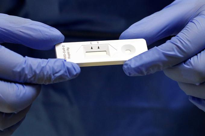 Hitri test, Antigenski test | Foto: Reuters