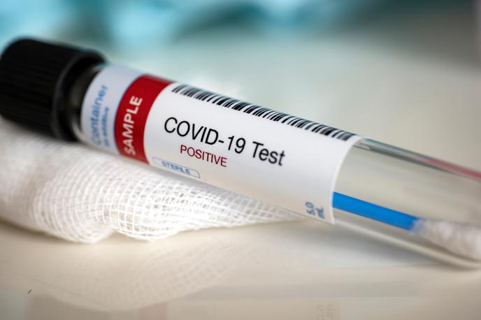 Koronavirus, Korona. Covid. Covid-19. Cepjenje. Test. Testiranje. Maske. | Foto Shutterstock