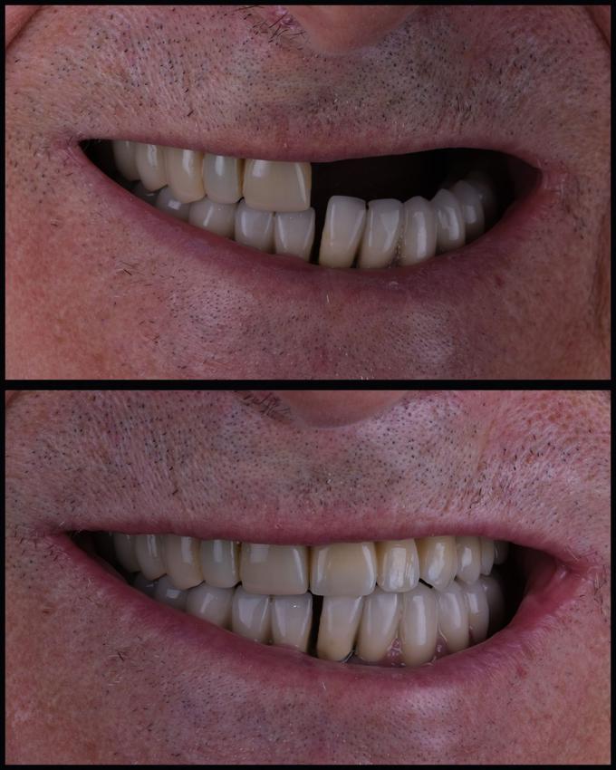 Oasis Dental | Foto: Oasis Dental