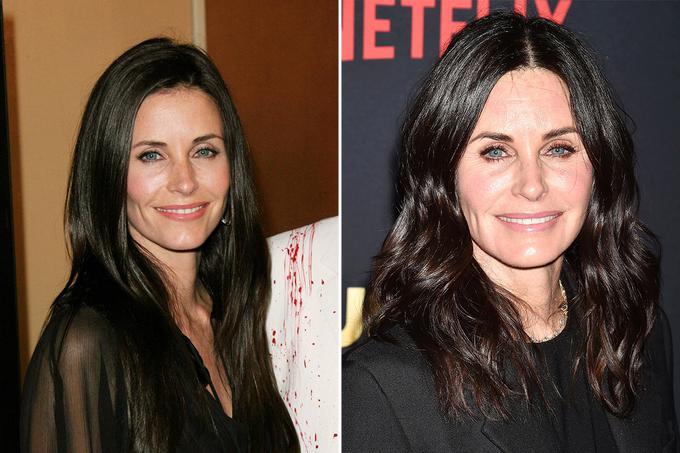 Courtney Cox B&A | Foto: 