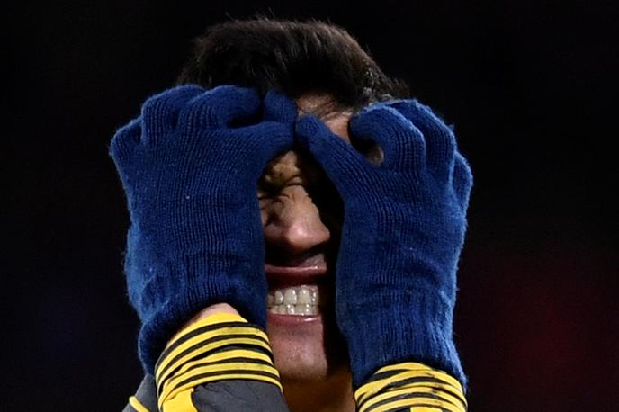 Alexis Sanchez | Alexis Sanchez bo moral počivati dlje časa. | Foto Reuters