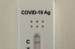 Koronavirus ne čaka delovnih skupin: toliko okuženih je bilo včeraj