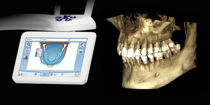 Izguba zob je lahko psihično in socialno škodljiva ter funkcionalno omejujoča. | Foto: Oasis Dental