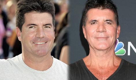 Simon Cowell priznal, da je pretiraval z botoksom: Sin me ni prepoznal