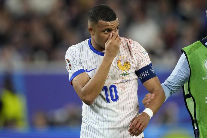 Mbappe Kylian poškodba Euro | Kylian Mbappe si je na uvodni tekmi prvenstva poškodoval nos. | Foto Guliverimage