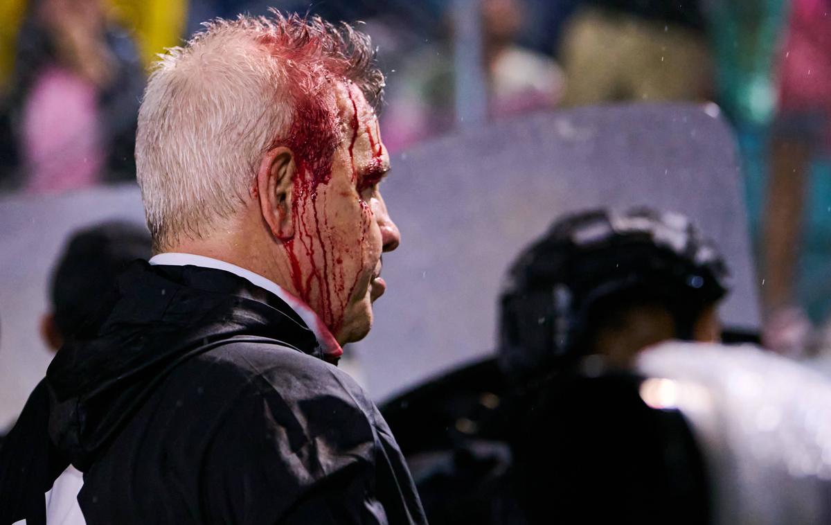 Javier Aguirre, Mehika | Mehiški selektor je okrvavljen zapuščal stadion v San Pedro Suli.  | Foto Guliverimage