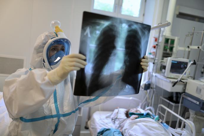 Rusija koronavirus | Primer obolelega za covid-19 potrjuje, da lahko bolezen pusti resne dolgotrajne posledice na zdravju ljudi tudi več mesecev po okužbi z novim koronavirusom. | Foto Reuters