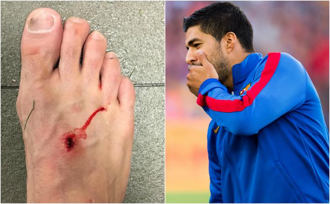 Luis Suarez se po štartu s podplatom na Brazilca ni opravičil in mu dal nasvet: "Vse, kar se zgodi na igrišču, ostane na igrišču." | Foto: 