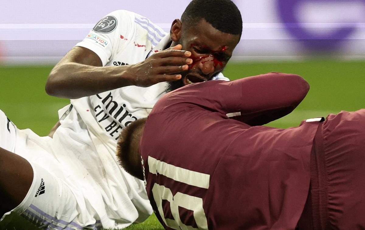 Rüdiger Real | Antonio Rüdiger je ob zadetku prejel močan udarec v čelo in obležal v bolečinah. | Foto Real Madrid