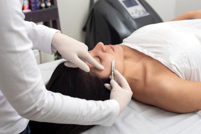 Dermaplaning lahko opravite sami doma ali pa v kozmetičnem salonu.
 | Foto: Shutterstock