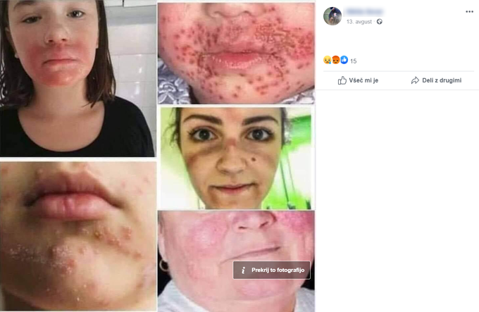 Ta kolaž fotografij je na Facebooku med drugim delil tudi na Facebooku vedno bolj znan slovenski nasprotnik zaščitnih mask, ki v prostem času brez maske provocira varnostnike v nakupovalnih središčih, pogovore snema s pametnim telefonom in videoposnetke objavlja na svojem profilu na Facebooku.  | Foto: Matic Tomšič / Posnetek zaslona