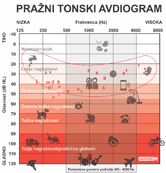 Pražna tonska avdiometrija je najpogostejša subjektivna preiskovalna metoda za ugotavljanje stanja sluha. Pražni tonski avdiogram je grafični prikaz slušnega praga pri posameznih frekvencah. | Foto: AUDIO BM D.O.O.