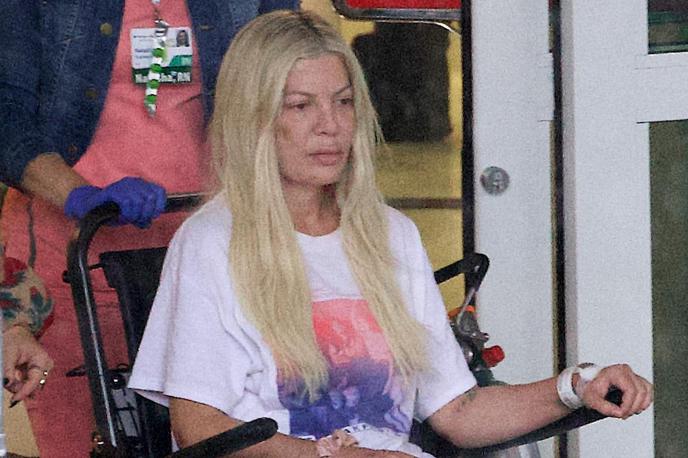 Tori Spelling | Ob odhodu igralke iz bolnišnice so fotografi opazili, da ima na obrazu več modric. | Foto Profimedia