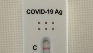 Koronavirus ne čaka delovnih skupin: toliko okuženih je bilo včeraj