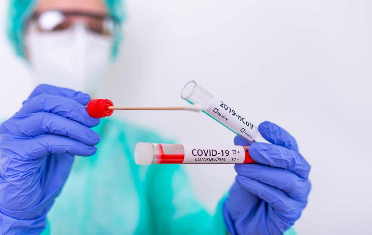 Koronavirus, Korona. Covid. Covid-19. Cepjenje. Test. Testiranje. Maske. | Z novim koronavirusom se je od začetka epidemije okužilo več žensk kot moških. | Foto Shutterstock