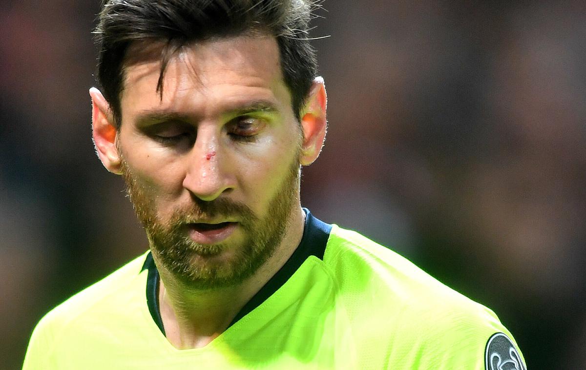 Lionel Messi | Takole je bil Lionel Messi videti po "srečanju" s Chrisom Smallingom. | Foto Getty Images