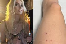 Taylor Momsen ugriznil netopir