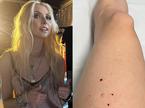 Taylor Momsen ugriznil netopir