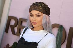 Kylie Jenner ima po petih letih spet naravne ustnice #foto