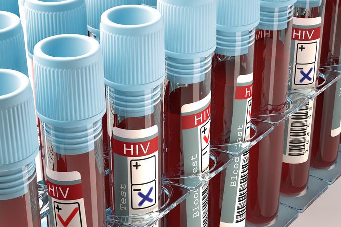 Aids. HIV. | Foto Thinkstock