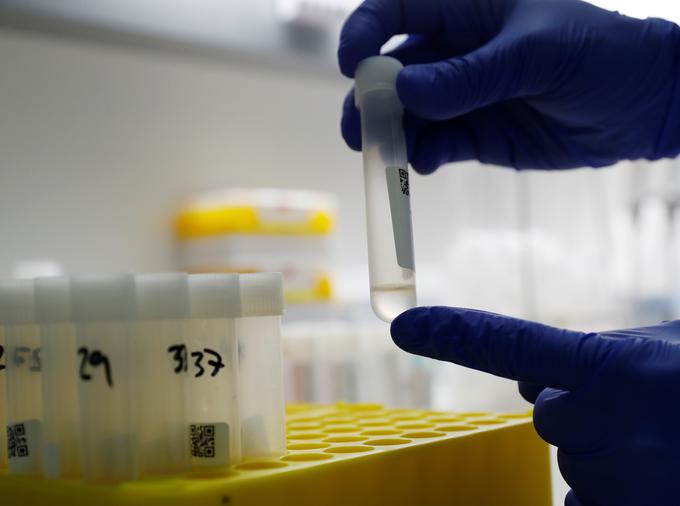 Problematična je mutacija N501Y, ki spreminja tako imenovani spike protein koronavirusa SARS-CoV-2 na način, da se ta lažje veže na receptorje ACE2 v človeških celicah.  | Foto: Reuters