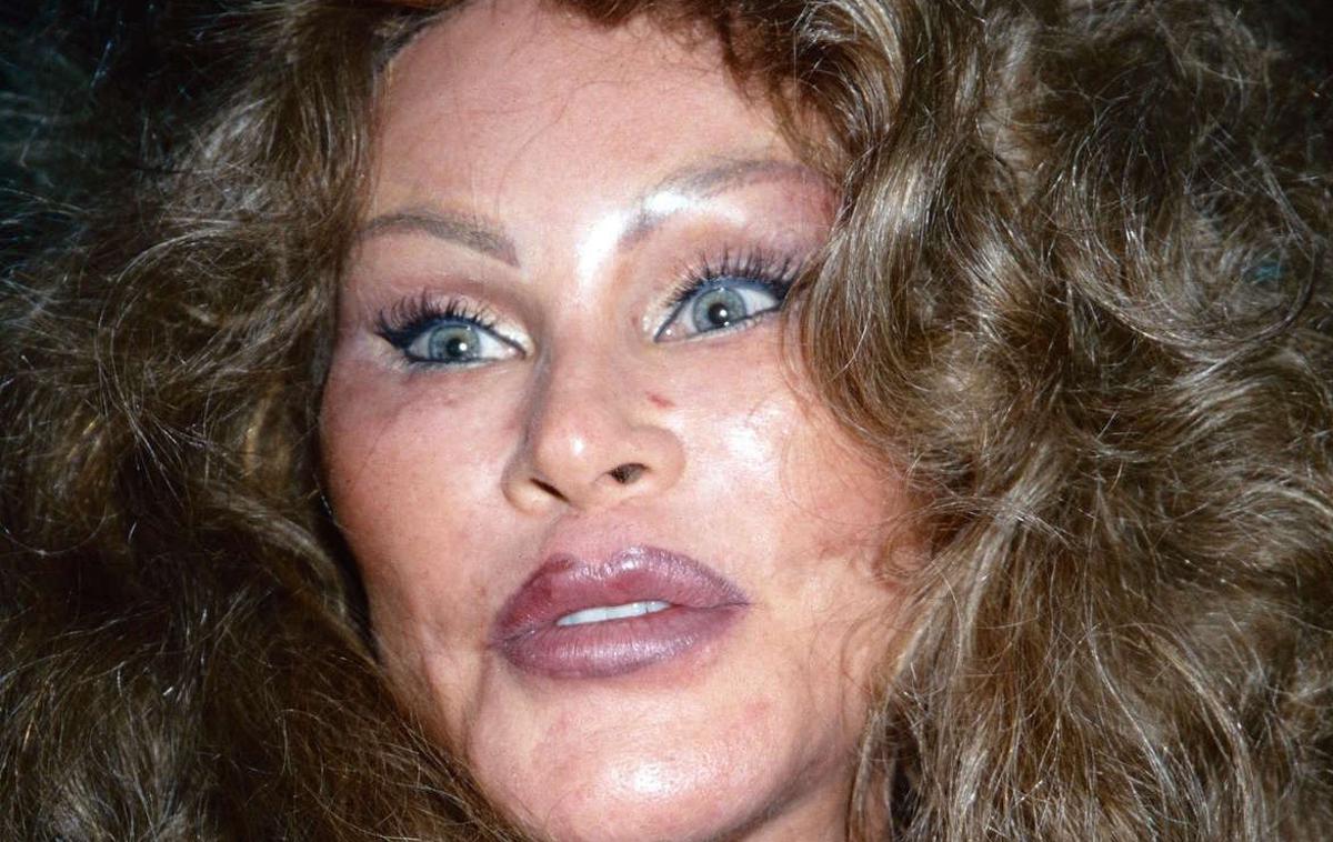 Jocelyn Wildenstein | Prve lepotne popravke je opravila že v 70. letih prejšnjega stoletja, posegi pa so se nato stopnjevali do te mere, da je po mnenju mnogih postala tako rekoč neprepoznavna, njene obrazne poteze pa so spominjale na mačje.  | Foto Profimedia