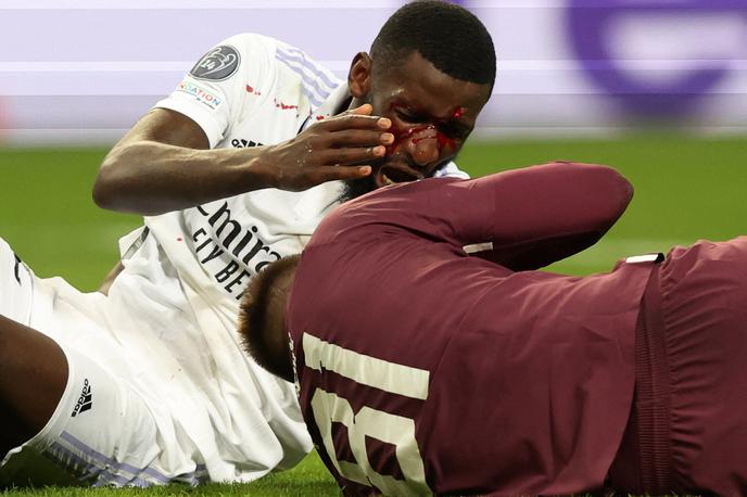 Rüdiger Real | Antonio Rüdiger je ob zadetku prejel močan udarec v čelo in obležal v bolečinah. | Foto Real Madrid