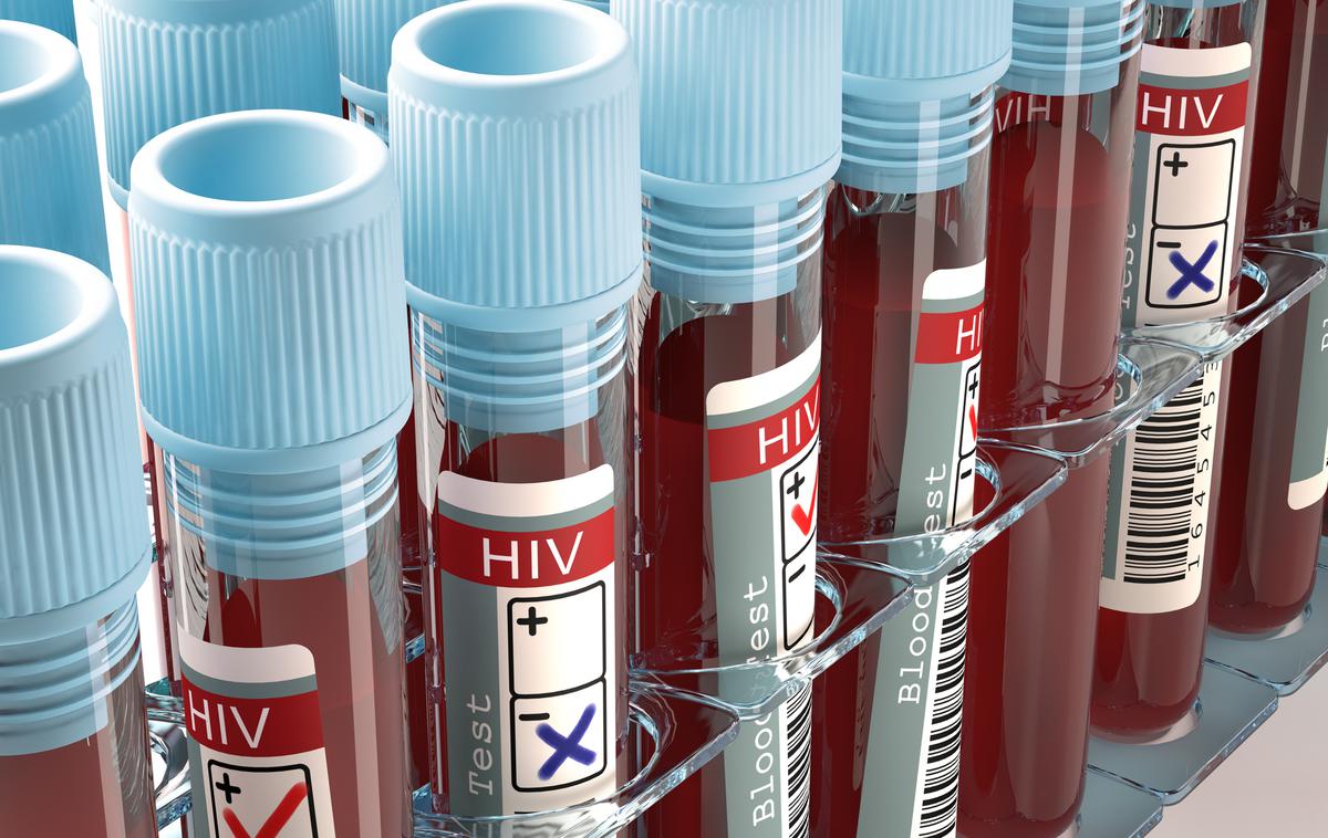 Aids. HIV. | Foto Thinkstock