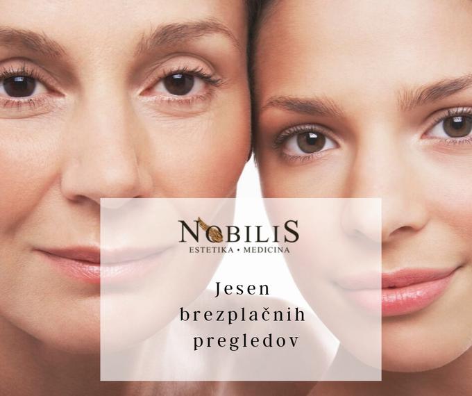 nobilis | Foto: 