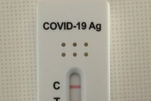 Janša koronavirus