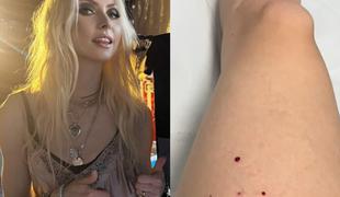 Ameriško pevko Taylor Momsen med koncertom ugriznil netopir #video