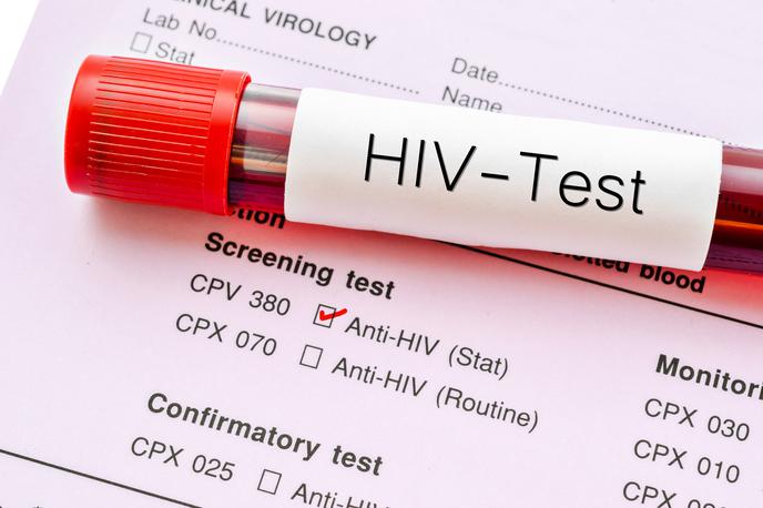 HIV Aids | Foto Thinkstock