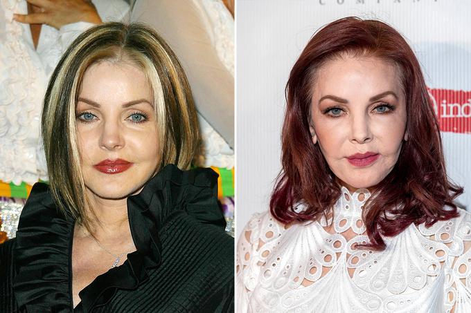 Priscilla Presley B&A | Foto: Guliverimage/Vladimir Fedorenko