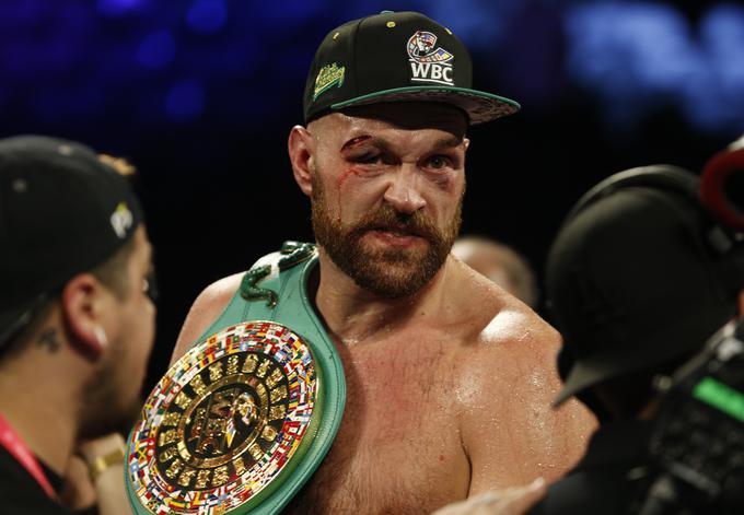 Oče Tysona Fury je bil kritičen do trenerskega štaba svojega sina. "Njegova moč je izginila." | Foto: Reuters