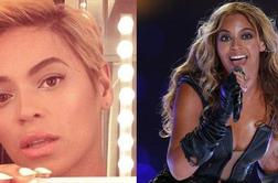 Lepotni šok tedna: Beyonce si je postrigla lase