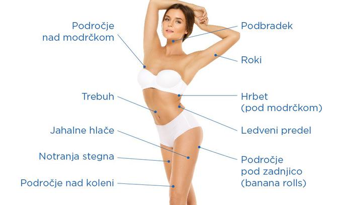 CoolSculpting poseg | Foto: 