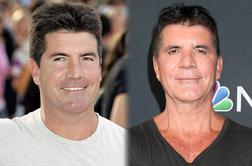 Simon Cowell priznal, da je pretiraval z botoksom: Sin me ni prepoznal