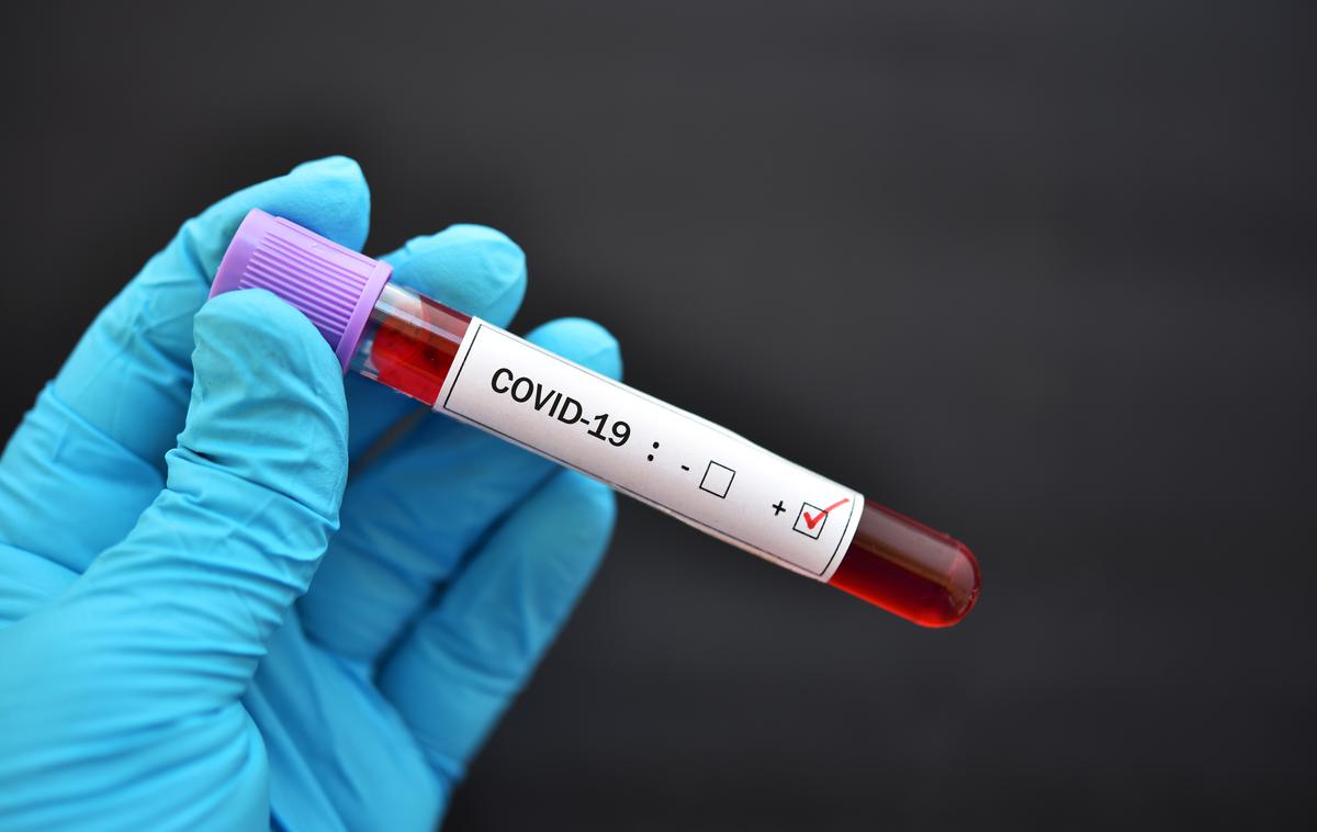 Koronavirus | V Sloveniji so zabeležili 34 okuženih ljudi, testirali so jih 1.643. | Foto Getty Images