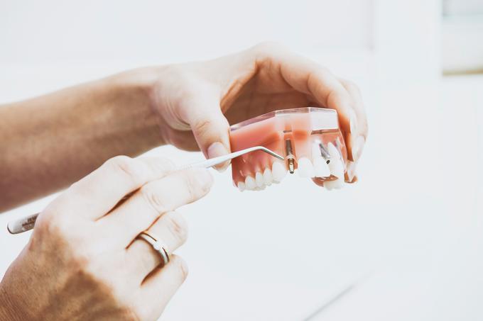 ORTOIMPLANT DENTAL SPA, SMT Dent | Foto: Unsplash