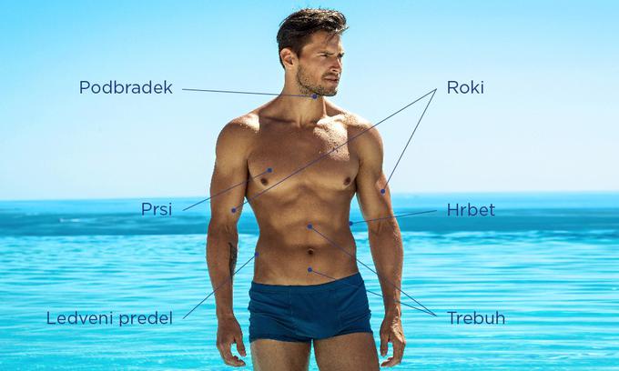 CoolSculpting poseg | Foto: 